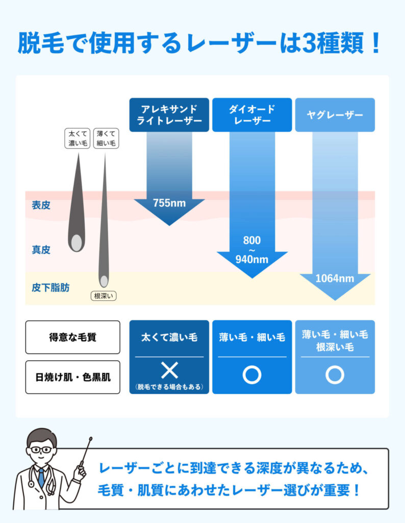 メンズ脱毛_レーザーの種類