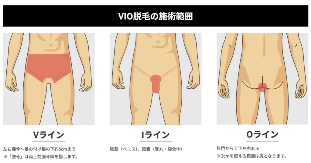 ゴリラ_VIO