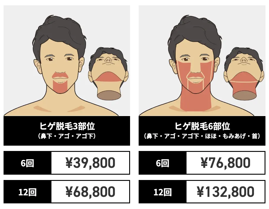 ゴリラ_ヒゲ料金