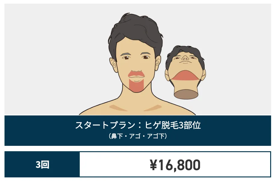 ゴリラ_ヒゲ料金_お試し