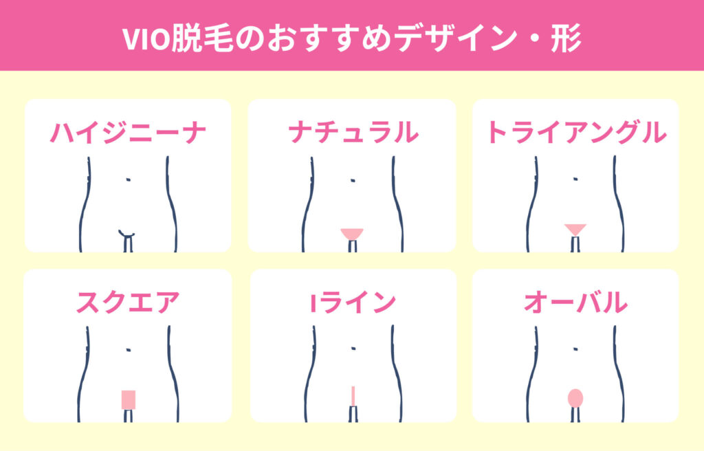 VIO脱毛のおすすめデザイン・形