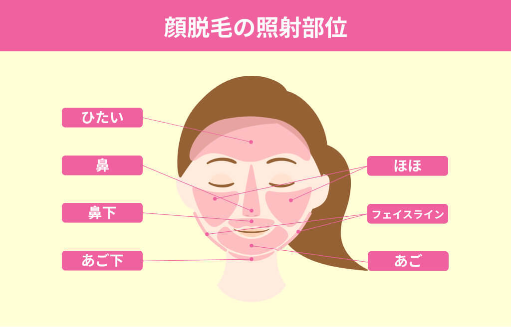 顔脱毛の照射部位